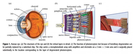 22 Retina 1